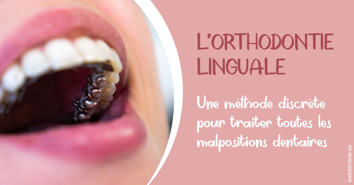 https://dr-boy-patrice.chirurgiens-dentistes.fr/L'orthodontie linguale 2