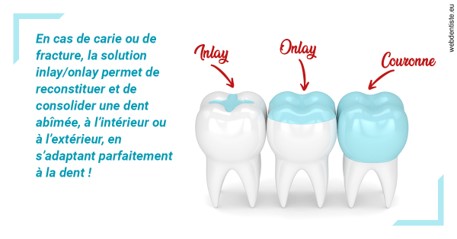 https://dr-boy-patrice.chirurgiens-dentistes.fr/L'INLAY ou l'ONLAY