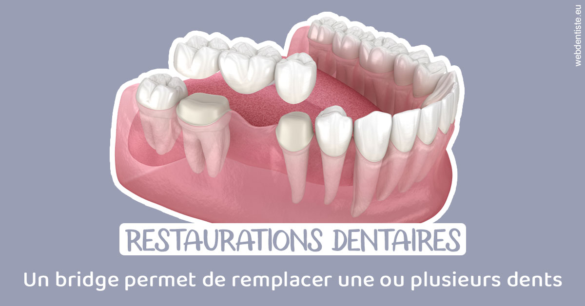 https://dr-boy-patrice.chirurgiens-dentistes.fr/Bridge remplacer dents 1
