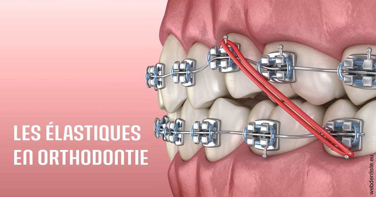https://dr-boy-patrice.chirurgiens-dentistes.fr/Elastiques orthodontie 2