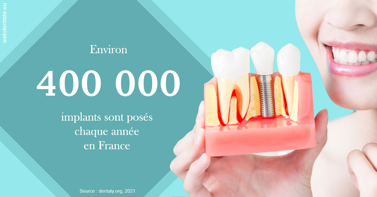 https://dr-boy-patrice.chirurgiens-dentistes.fr/Pose d'implants en France 2